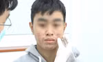 Tan nát da vì dùng mỹ phẩm 'dỏm'
