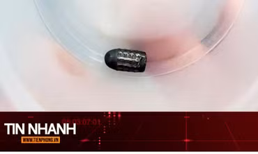 TIN NHANH: Hy hữu người phụ nữ sống sót dù bị đạn lạc găm trúng đầu