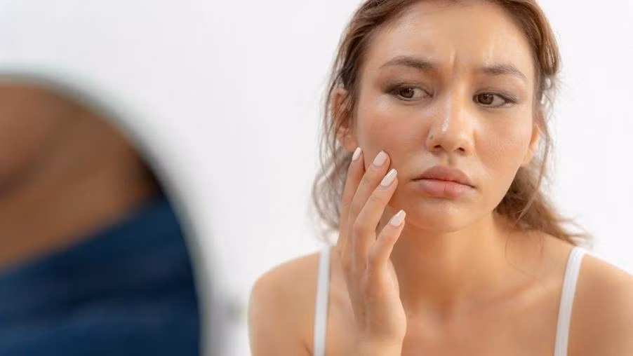 Nhiều phụ nữ chăm skincare kỹ nhưng da vẫn xỉn màu và dễ xuất hiện nám