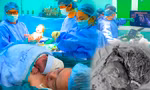 Bác sĩ 'vá' mạch máu trong bụng mẹ, cứu thai nhi mắc khối u khổng lồ