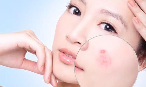 Có cần thiết đầu tư mua máy rửa mặt hay không?