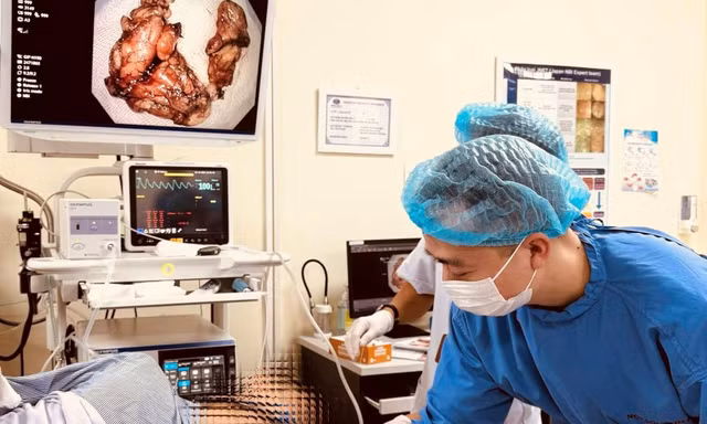 Kĩ thuật cao xử lí triệt để khối u kích thước lớn