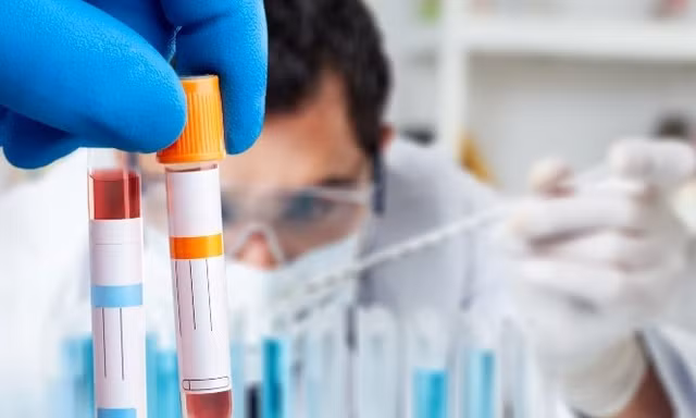 Sốt xuất huyết diễn biến khó đoán, nhiều ca chuyển nặng nhanh