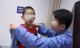 Một bệnh nhi điều trị sùi mào gà tại BV Da liễu Trung ương sau khi sắt bao quy đầu tại phòng khám bà Hiền.
