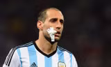 Tuyển thủ Argentina tí tởn khoe hình sứt môi trên mạng