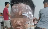 Tự mua thuốc nổ trên mạng về chế pháo, nhiều trẻ bị trọng thương