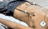 Bệnh nhân Nguyễn Phúc Duy lúc mới nhập viện.