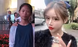 phẫu thuật thẩm mỹ
