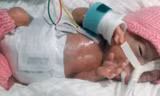 Emilia lúc mới sinh. Ảnh: CEN.
