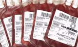 Các kháng nguyên quyết định một người thuộc nhóm máu nào. Ảnh: Wisegeekhealth.