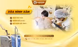 Viện Thẩm Mỹ Ladova giúp hàng nghìn người xóa xăm thành công mỗi năm