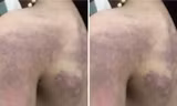 Làm rõ thông tin bé gái lớp 3 'bị giáo viên đánh bầm tím người'
