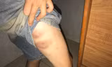 Bé trai 9 tuổi vết thương đầy người, nghi bị bố và bà nội bạo hành
