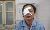 Bệnh nhân bị mất thị lực vĩnh viễn mắt bên phải.