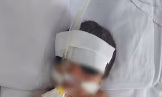 Bé trai sinh non bị mẹ bỏ lại ở bệnh viện 