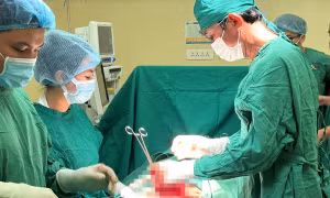 Một phụ nữ có khối u xơ tử cung lớn như bào thai 5 tháng tuổi