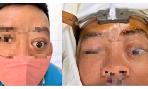 Sau hàng chục năm bị tai nạn giao thông, người đàn ông phát hiện điều bất ngờ