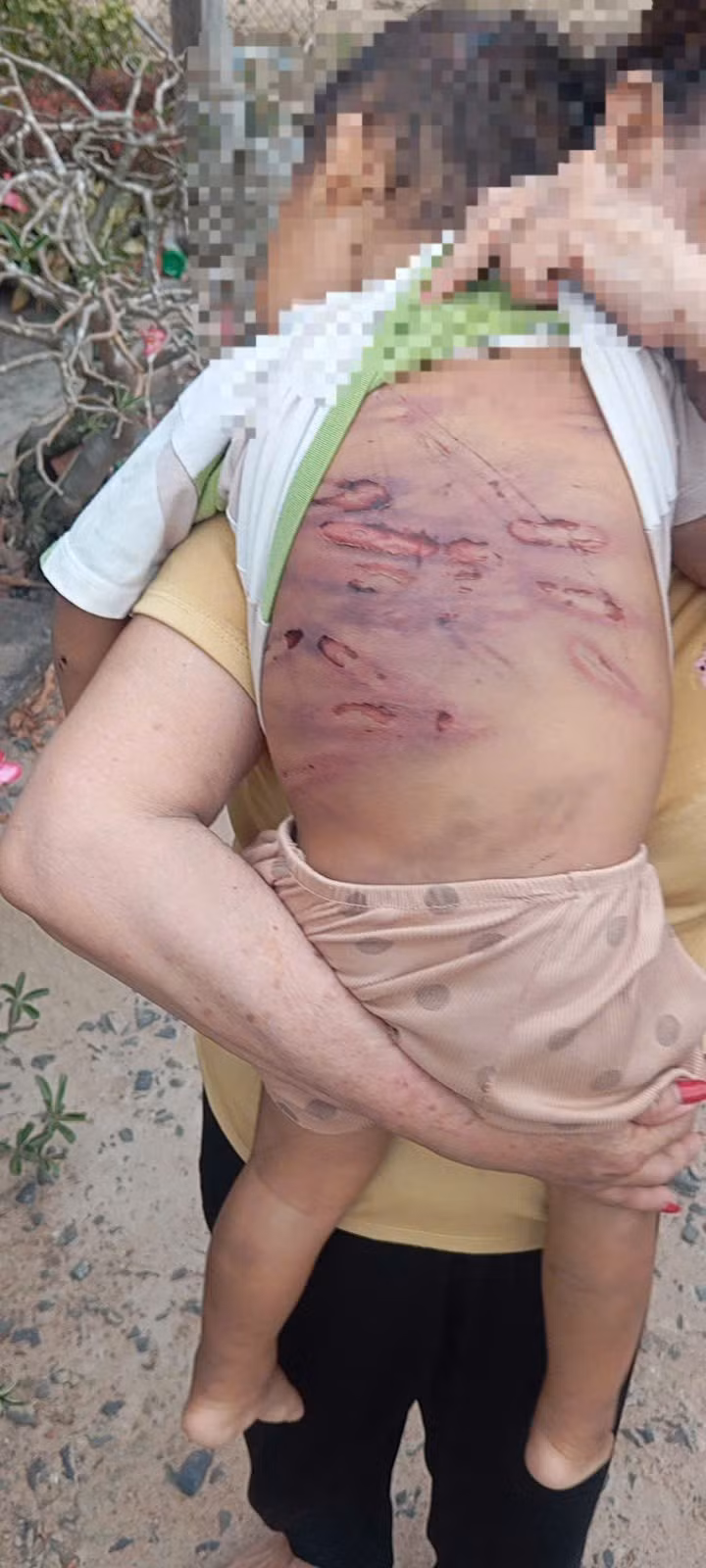 hinh-anh-vet-thuong-cua-chau-k-2.jpg