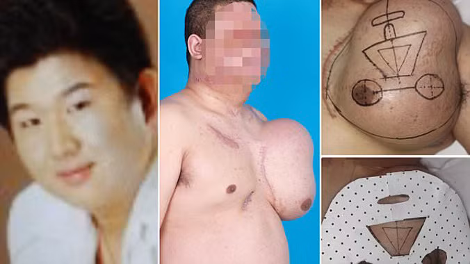 Yan trước khi bị điện giật và khuôn mặt bác sĩ đang tái tạo trên ngực trái.