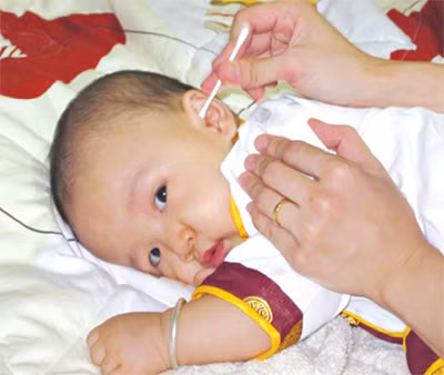 Lấy ráy tai cho trẻ phải hết sức cẩn thận