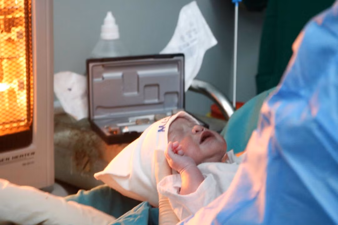 Mổ bắt con cho sản phụ hẹp khí quản nặng ảnh 3