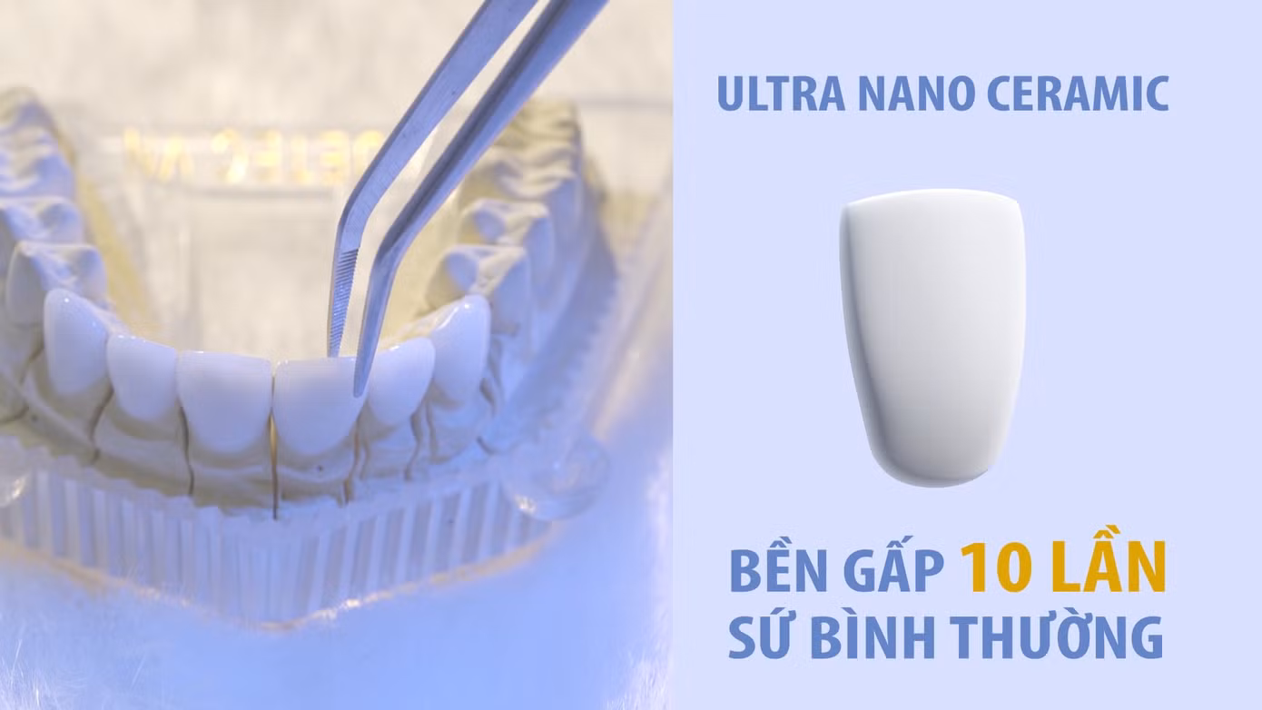 Mài răng bọc răng sứ và những di chứng không thể ngờ ảnh 4