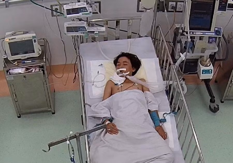Cậu bé rơi vào tình trạng nguy kịch sau khi bị rắn độc cắn lúc nửa đêm