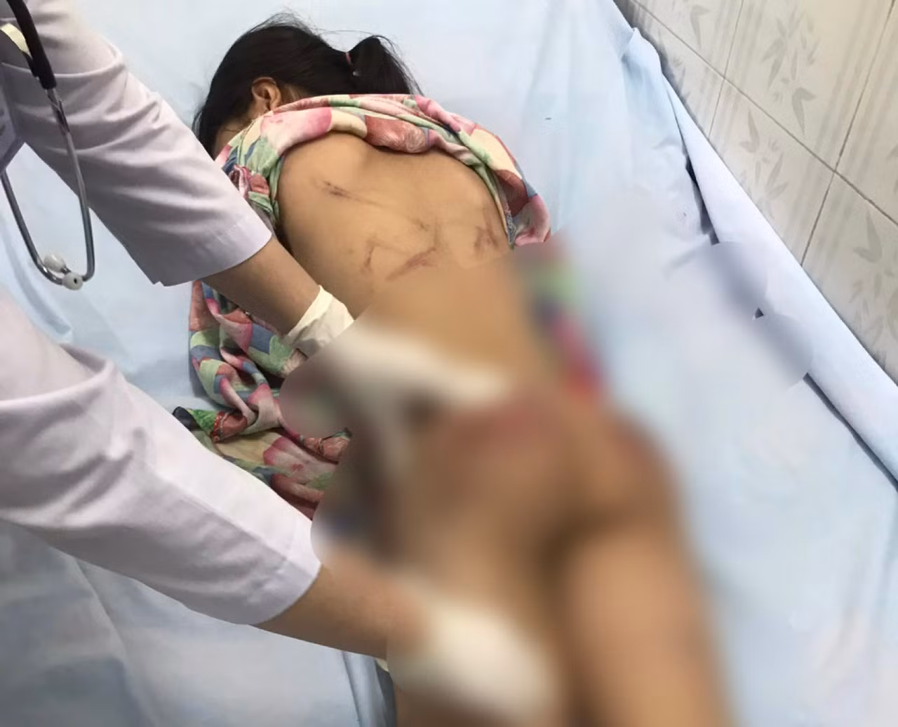 Bác sĩ kiểm tra các vết thương trên người bé H.T.L. Ảnh: CTV.