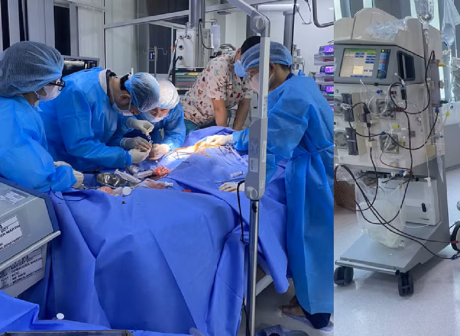 Ê kíp bác sĩ đã nỗ lực cấp cứu, đặt ECMO giúp bệnh nhi vượt qua nguy kịch