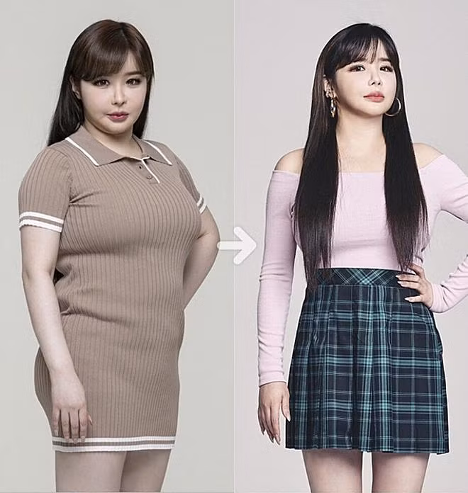 Park Bom giảm 11 kg cuối năm 2021.