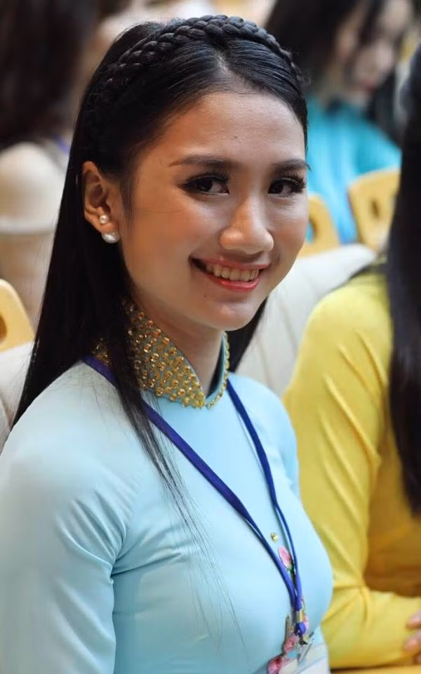 Suýt lỡ thi Hoa hậu Việt Nam vì... răng sứ ảnh 2