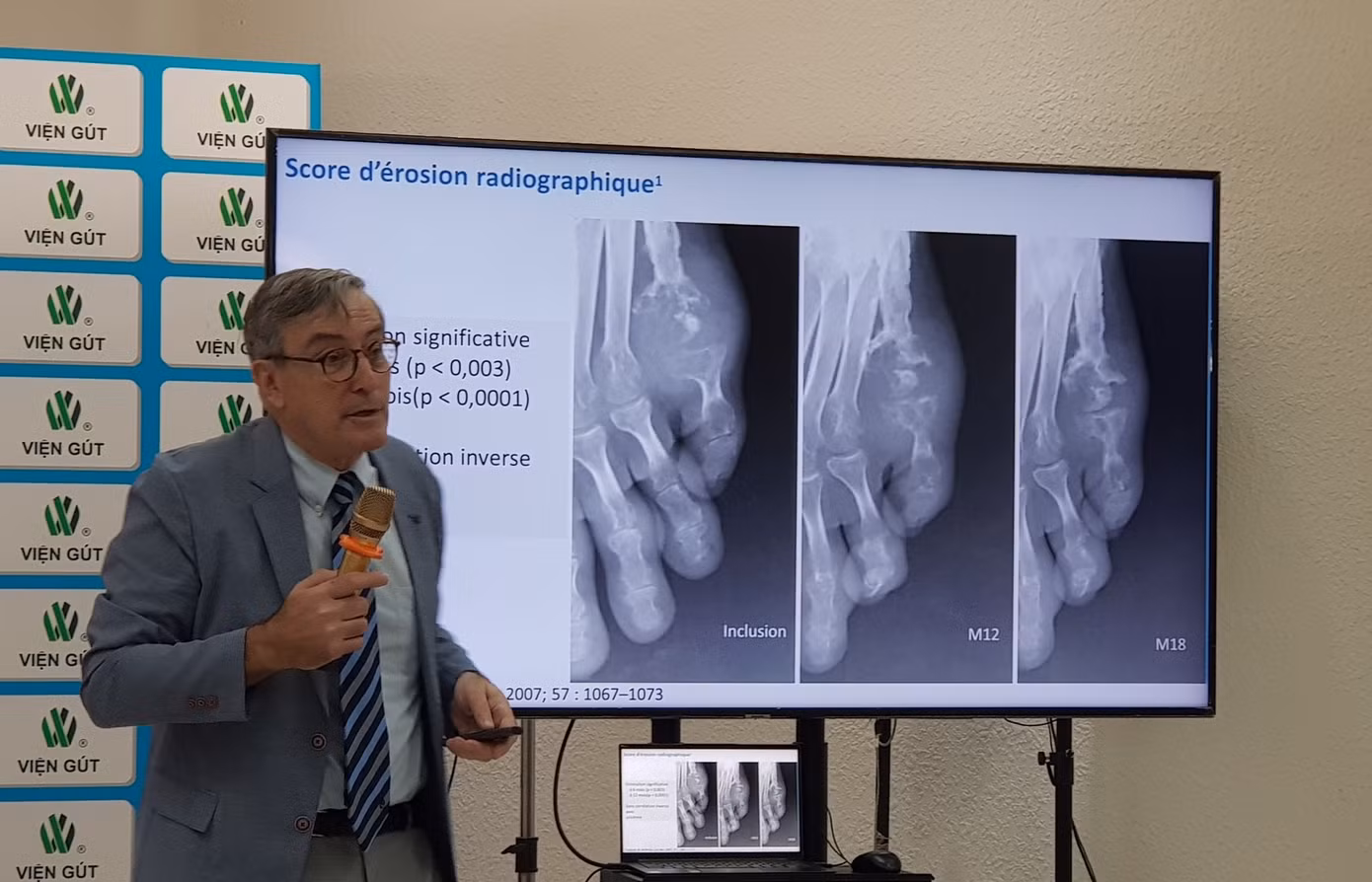GS Thomas Bardin đánh giá về mô hình điều trị khả quan đang được áp dụng tại Viện Gút