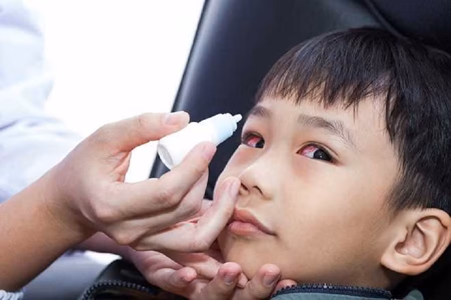 Sở Y tế TPHCM khẳng định thông tin bệnh đau mắt đỏ lây qua đường nước uống là thông tin không có cơ sở khoa học. Ảnh minh họa