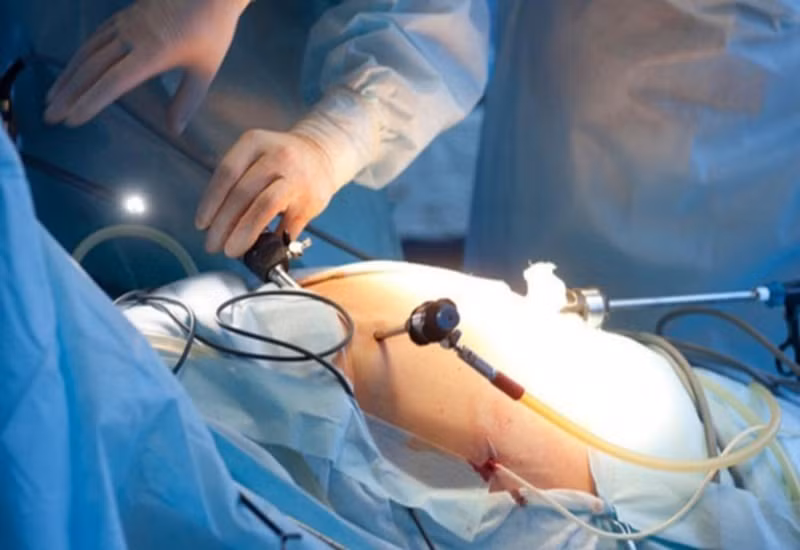Các bác sĩ đã thực hiện nội soi ổ bụng lấy dị vật trong đường tiêu hóa cho bệnh nhi (ảnh minh họa)