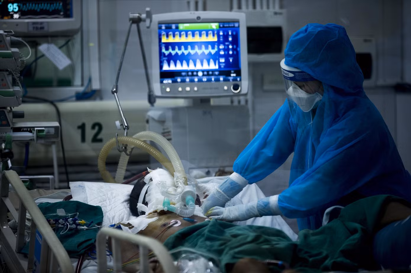 Bệnh nhân nặng điều trị tại BV bệnh Nhiệt đới Trung ươngảnh: Hà Minh