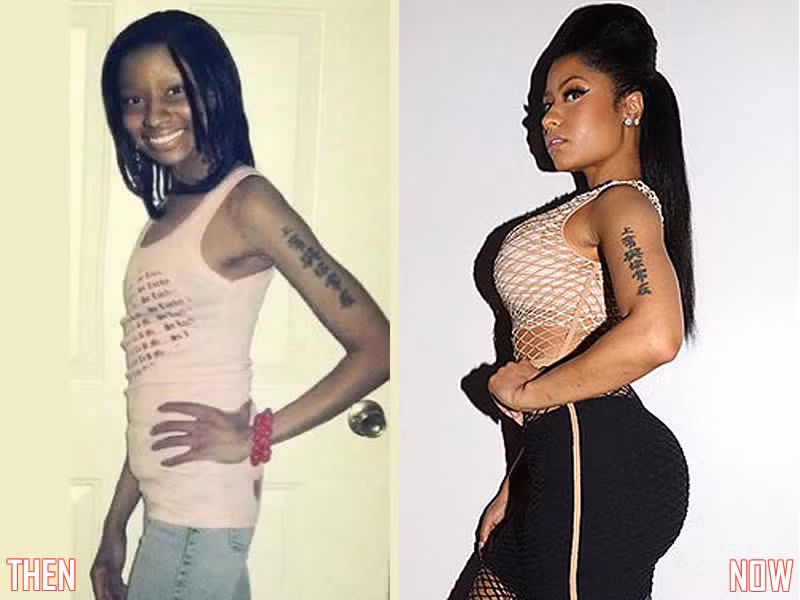 Bơm căng phồng, Nicki Minaj nổi bật với đường cong nhân tạo ảnh 8