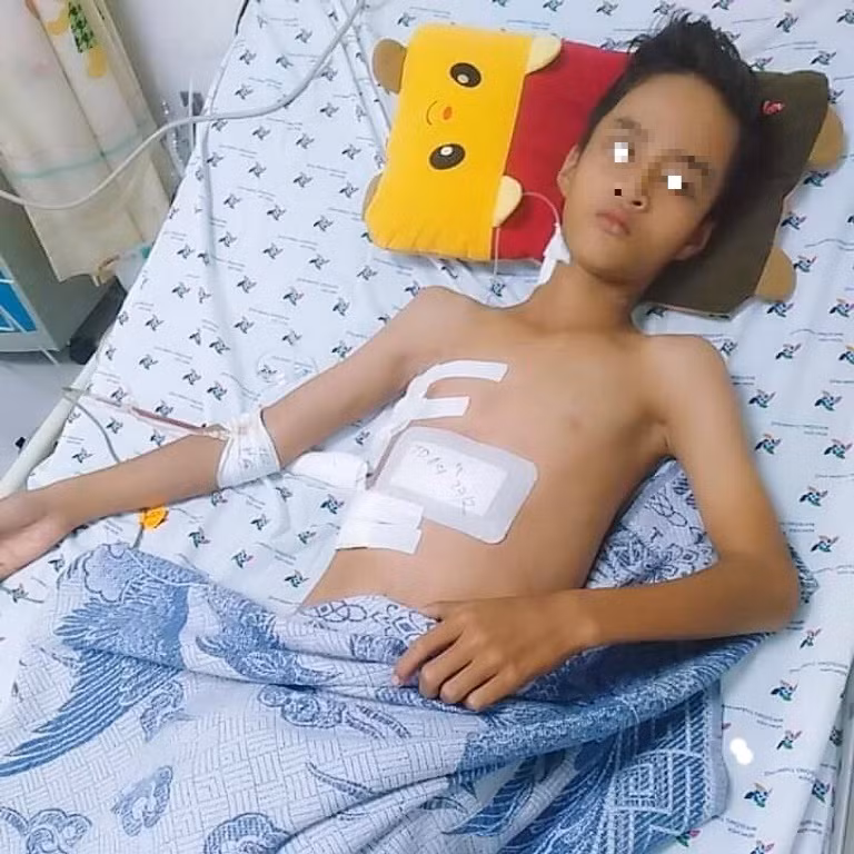 Bé trai 13 tuổi bị thanh sắt đâm thấu ngực khi đi cắt lúa ảnh 2