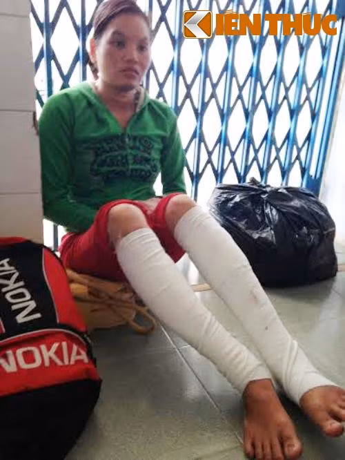 Hai mẹ con bỏng nặng vì bị ném 'bom' xăng ảnh 1