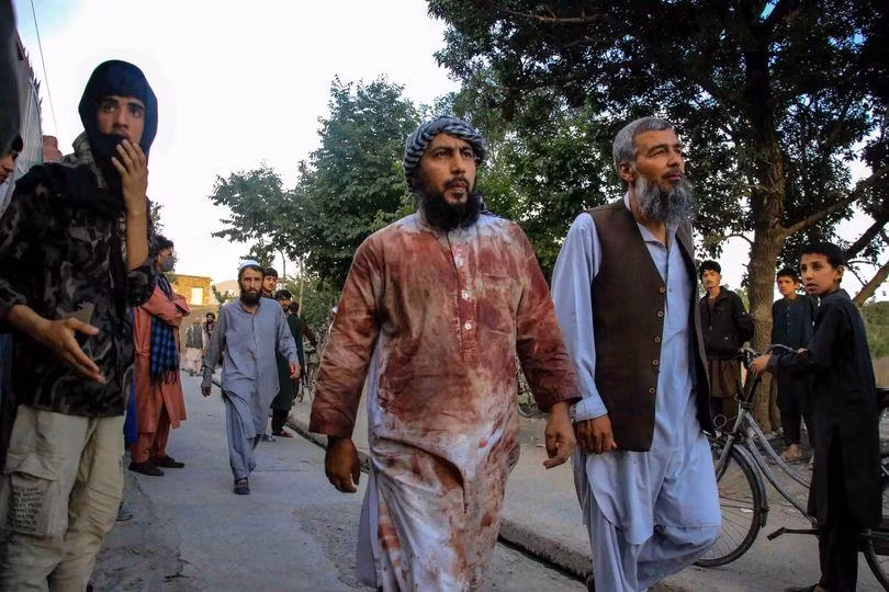 Một vụ đánh bom tại nhà thờ Hồi giáo ở Kabul, Afghanistan, hồi cuối tuần trước đã khiến ít nhất 10 người thiệt mạng và hàng chục người khác bị thương. Ảnh: EPA