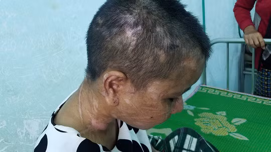 Anh rơi nước mắt khi thấy em gái bị tra tấn tới 'thân tàn ma dại' ảnh 4