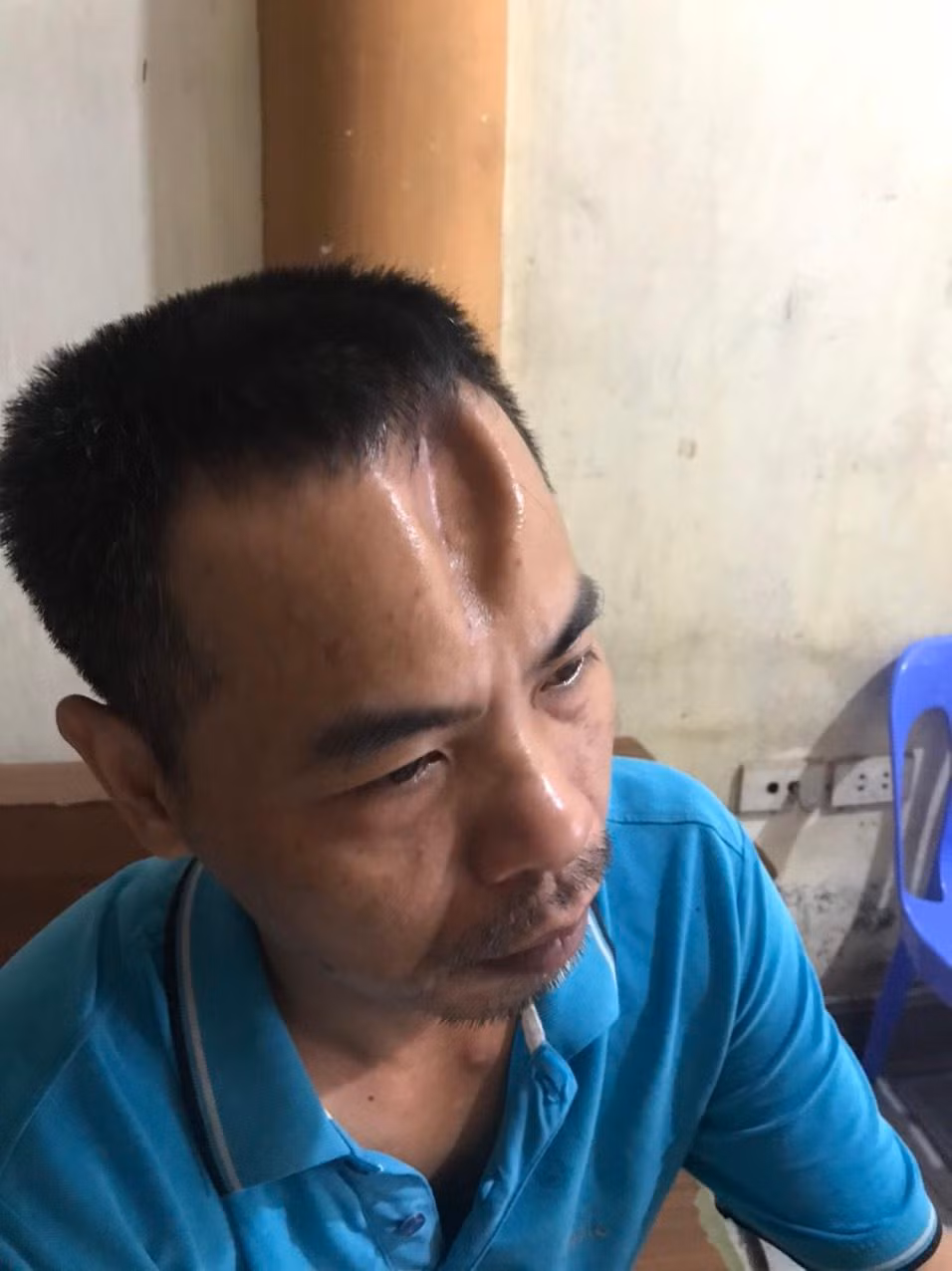Anh Thưởng sau khi được xuất viện.