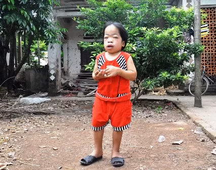 18 tuổi nhưng Loan chỉ cao gần 80cm, nặng 22kg..