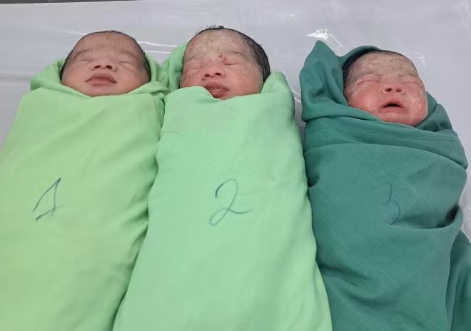 Sức khỏe của 3 bé sơ sinh ổn định sau khi phẫu thuật sinh non