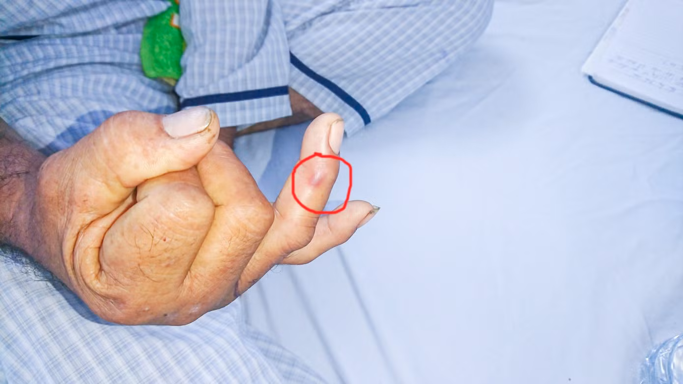 Nhiều người nhập viện do rắn lục đuôi đỏ cắn ảnh 2