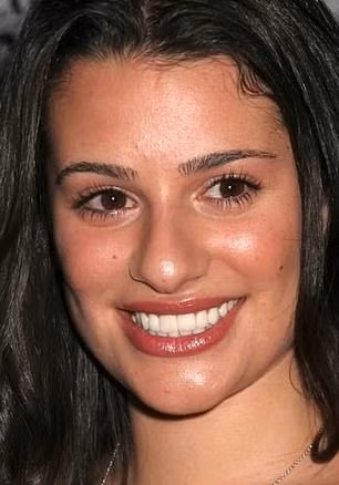 Lea Michele có dấu hiệu má hóp đặc trưng của việc trải qua thủ thuật loại bỏ mỡ má.