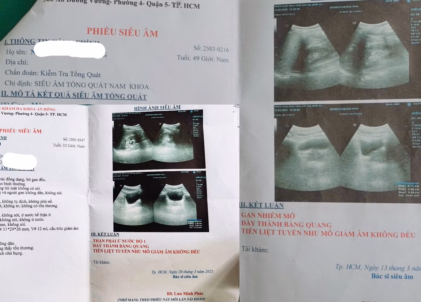 Kết quả siêu âm của phóng viên và bệnh nhân H. "vô tình" lại như nhau- ảnh P.V