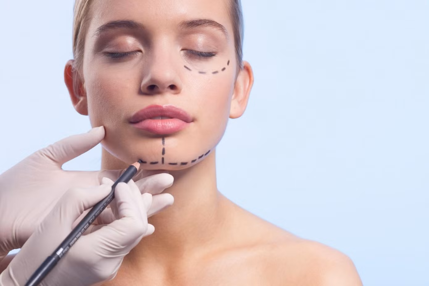 Người phụ nữ bị botox chảy ra ngoài sau khi bơm môi ảnh 1