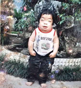 Em Trần Văn Đức lúc còn sống, khi 13 tuổi chẳng khác gì đứa trẻ lên 3..