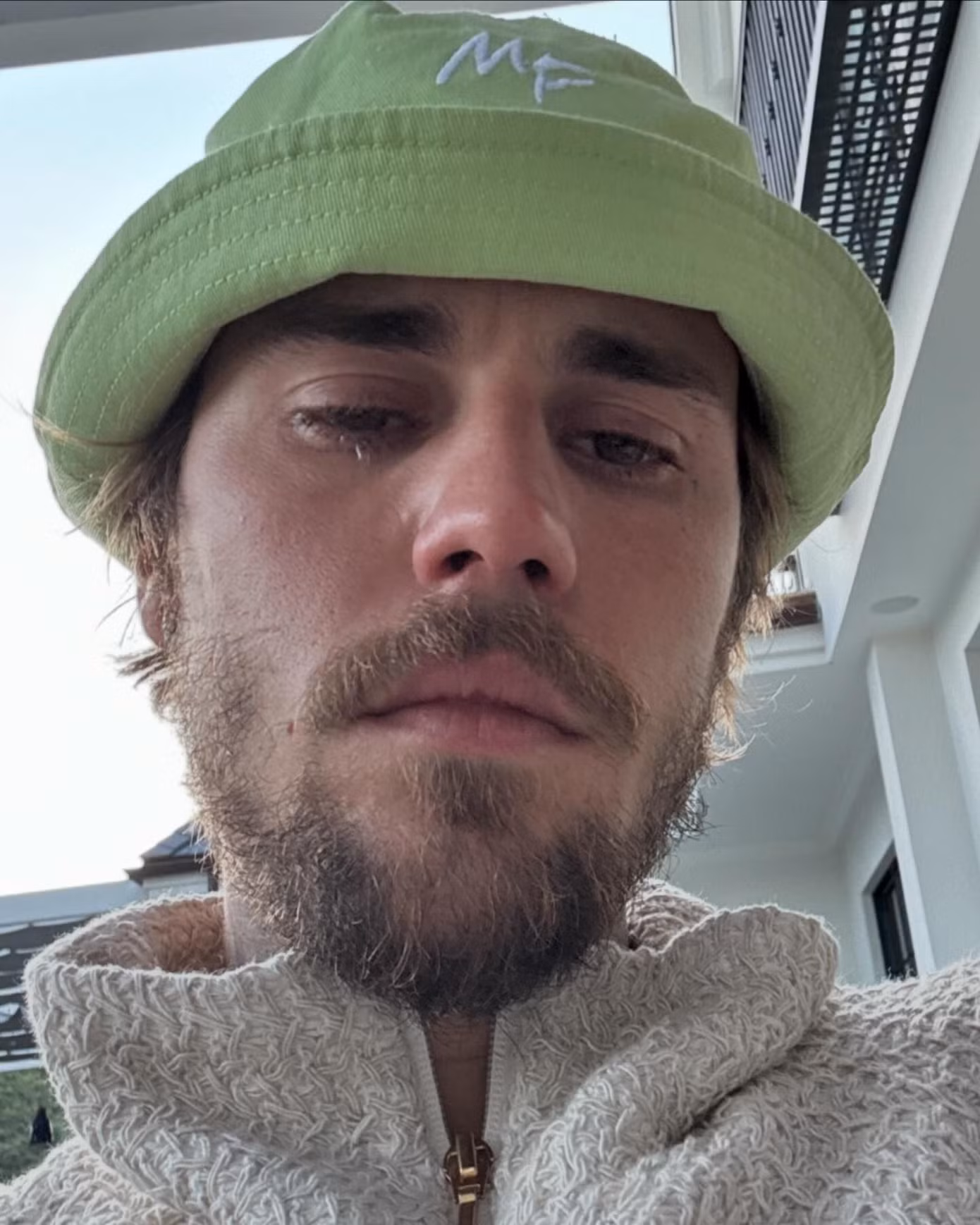 Justin Bieber khiến người hâm mộ hoang mang vì đăng ảnh khóc. Ảnh: IG.