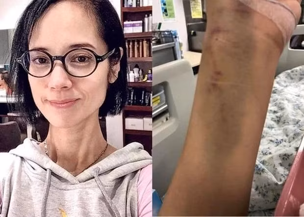 Trịnh Diễm Lệ sức khỏe xuống dốc vì bệnh tâm lý và chứng biếng ăn.